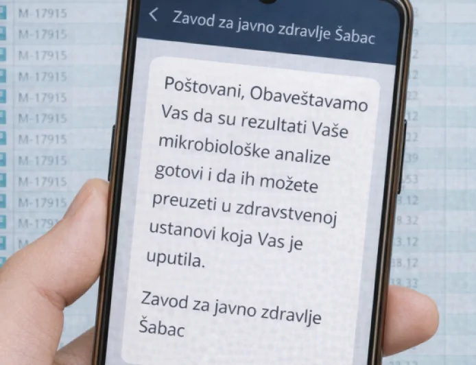SMS obaveštenja za pacijente