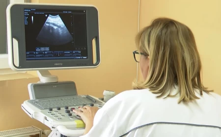 Dobar odlziv meštana Lipolista na preventvne preglede